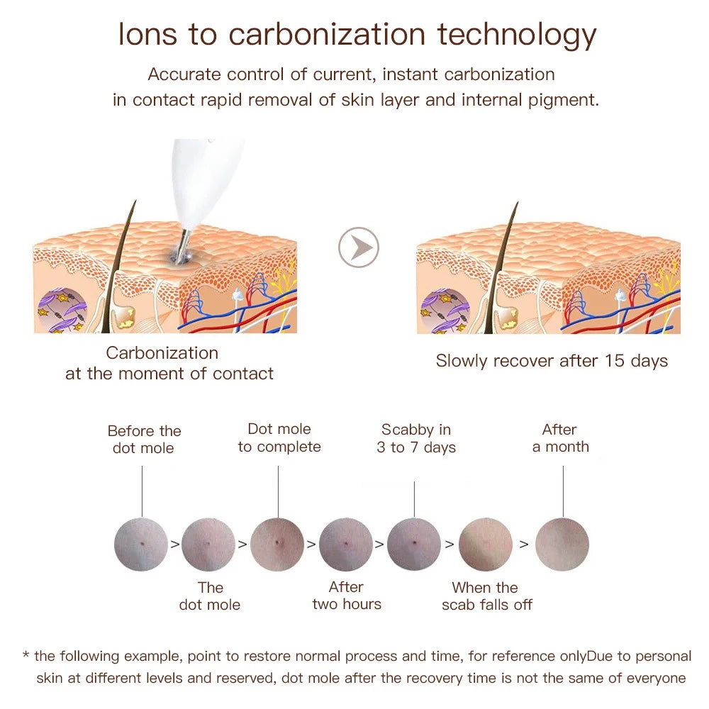 Stylo laser plasma 9 niveaux, élimination verrues et étiquettes