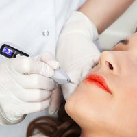 Stylo laser plasma 9 niveaux, élimination verrues et étiquettes