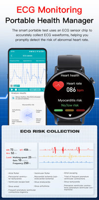 Montre connectée ECG glycémie sans prélèvement analyse sanguine